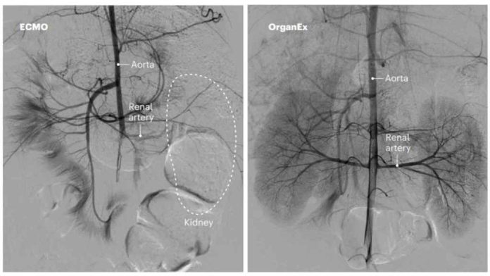 OrganEx: rendere reversibile la morte