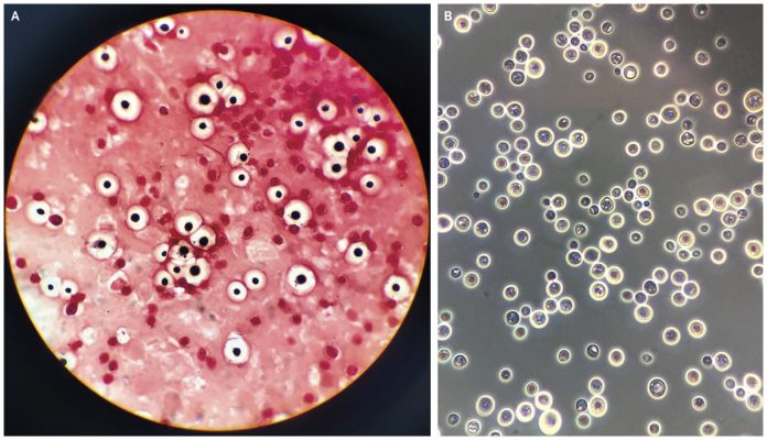 Scoperta una nuova modalità di evoluzione