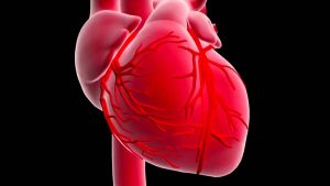 Infarto 