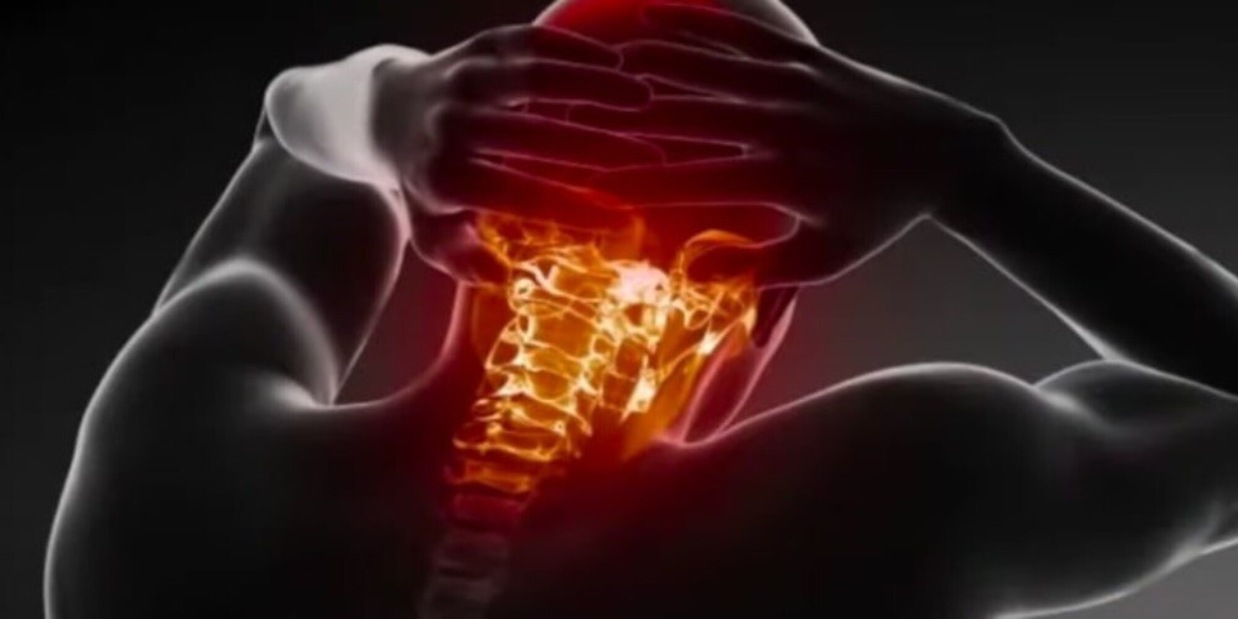 Sindrome dell'Avana