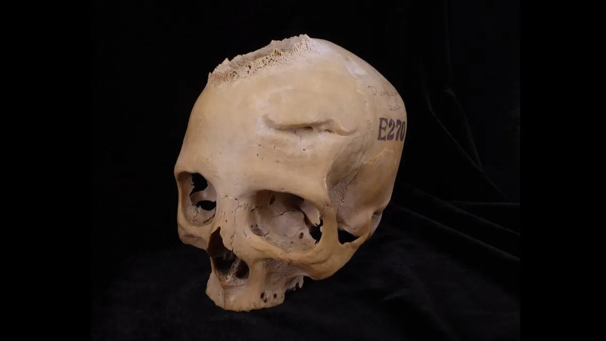 Medicina egizia