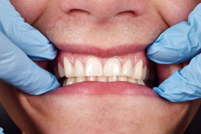 Rigenerazione dentale