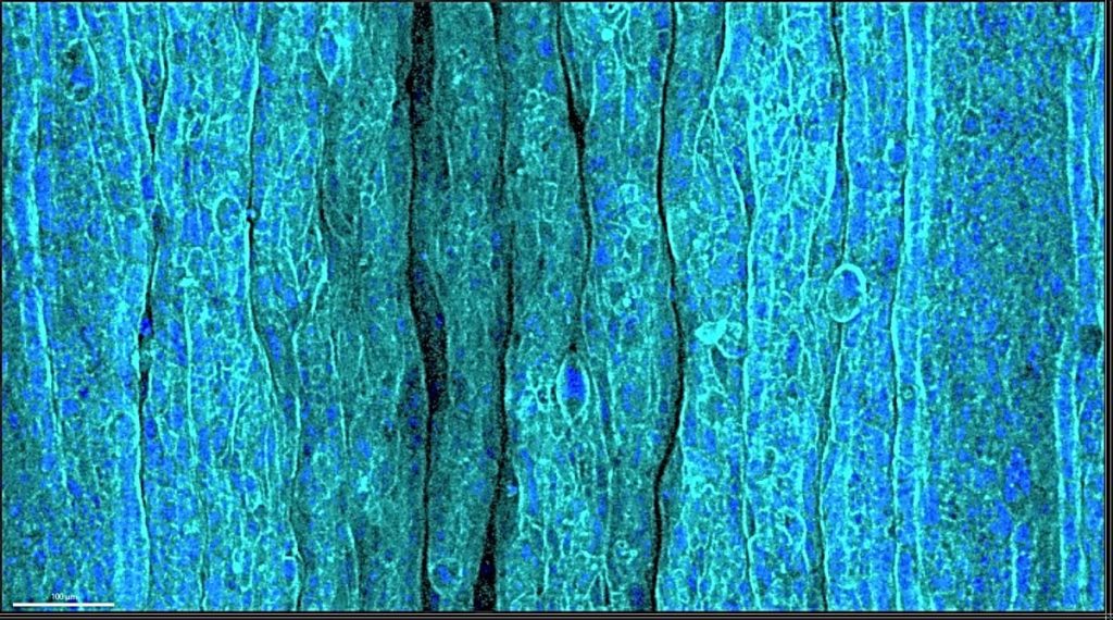 Formazione delle rughe: svelato il segreto della pelle che invecchia 1 Immagine di epitelio rugoso sullo strato di idrogel dell'ECM in risposta alla compressione. Credito: POSTECH