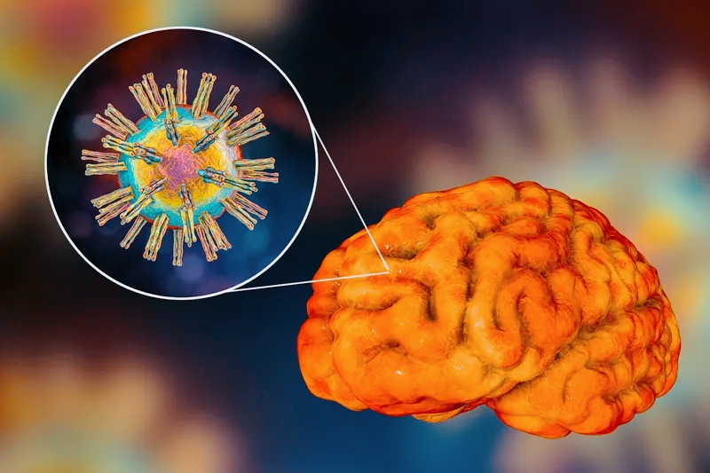 Il virus dell'herpes simplex di tipo 1 invade silenziosamente il cervello umano 1 Herpes simplex di tipo 1