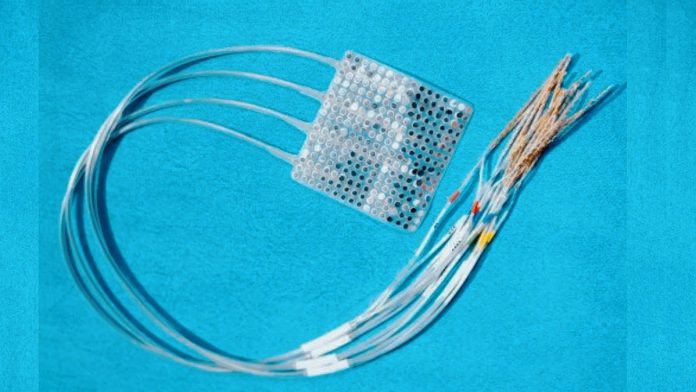 Interfaccia cervello-computer: uomo paralizzato muove braccio robotico con il pensiero