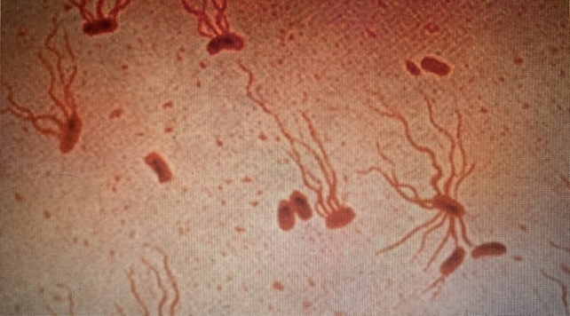 Febbre tifoide: la minaccia multiresistente riemerge con forza