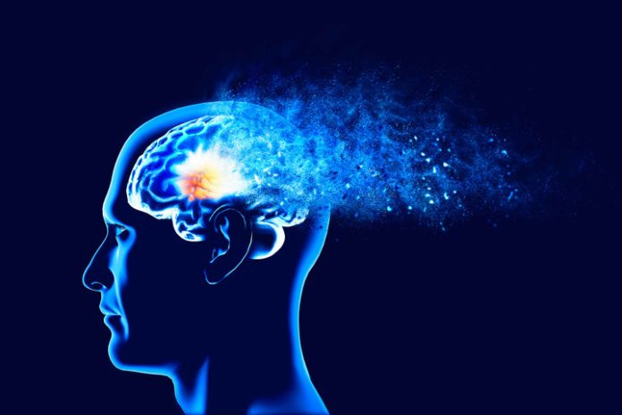 Malattia di Alzheimer: un nuovo farmaco promette di bloccarne la progressione