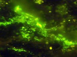 Scoperti microrganismi viventi di 2 niliardi di anni fa: una finestra sull'alba della vita
