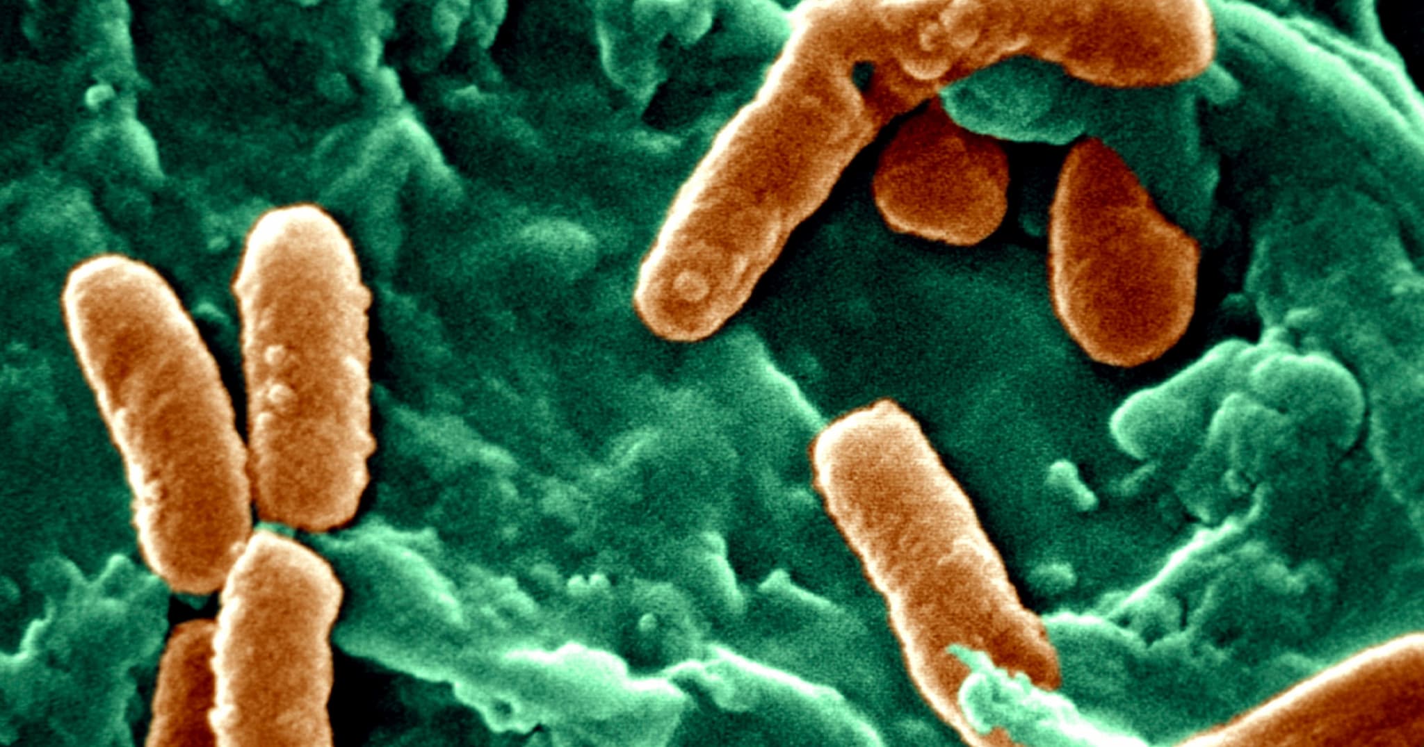 Pseudomonas aeruginosa: il superbatterio mangia-plastica circola negli ospedali e ha già causato 559.000 decessi 1 Pseudomonas aeruginosa: il superbatterio mangia-plastica circola negli ospe e ha già causato 559.000 decessi