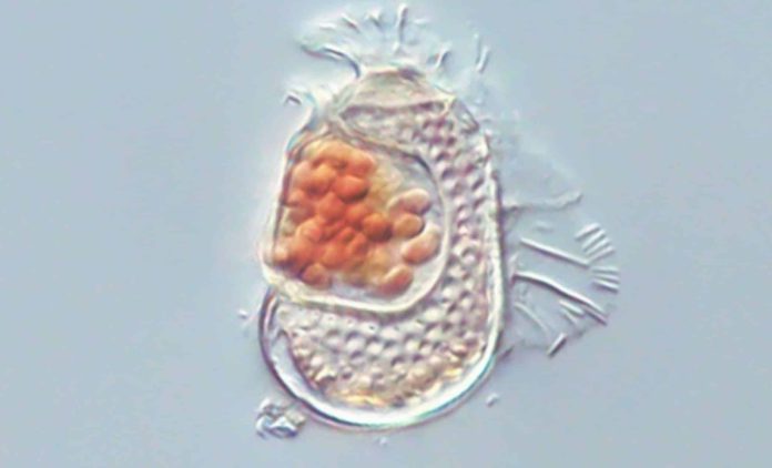 Sukunaarchaeum mirabile: il nuovo microrganismo che sfida la definizione di vita