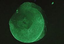 Cetriolo di mare: frammenti di tessuto sopravvivono per 3 anni in acqua non sterile Cetriolo di mare: frammenti di tessuto sopravvivono per 3 anni in acqua non sterile
