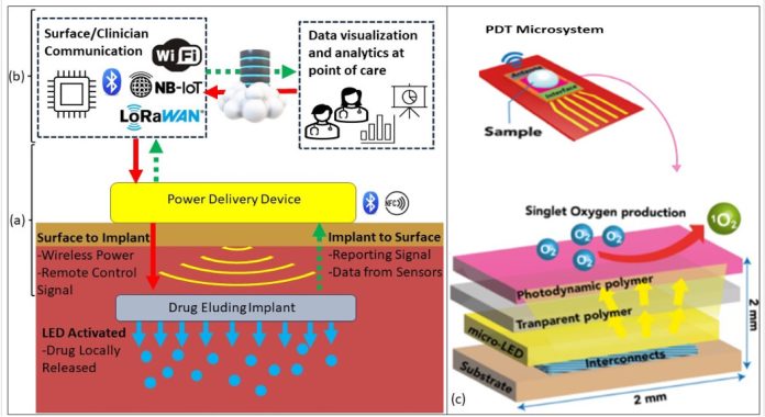 Tumore alla vescica, nuove speranze dalle tecnologie impiantabili